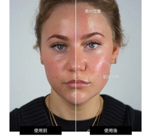 ZIIP HALO効果
